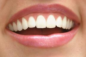 Smiling Mouth with White Teeth