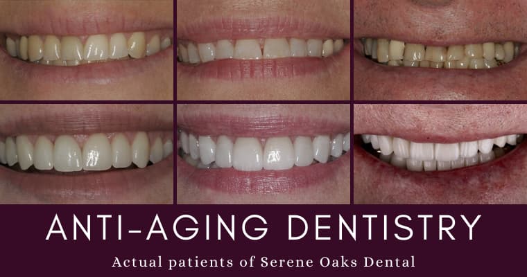 Three sets of before and after photos of anti-aging dentistry patients at Serene Oaks Dental