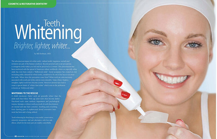 Teeth Whitening article cover