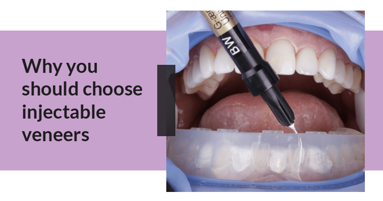 Injectable veneers being placed with with the text, "Why you should choose injectable veneers."