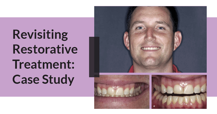 How Cosmetic Dentistry Gave Dr. Loween a Beautiful Smile & Comfortable Bite (Before & After Photos)