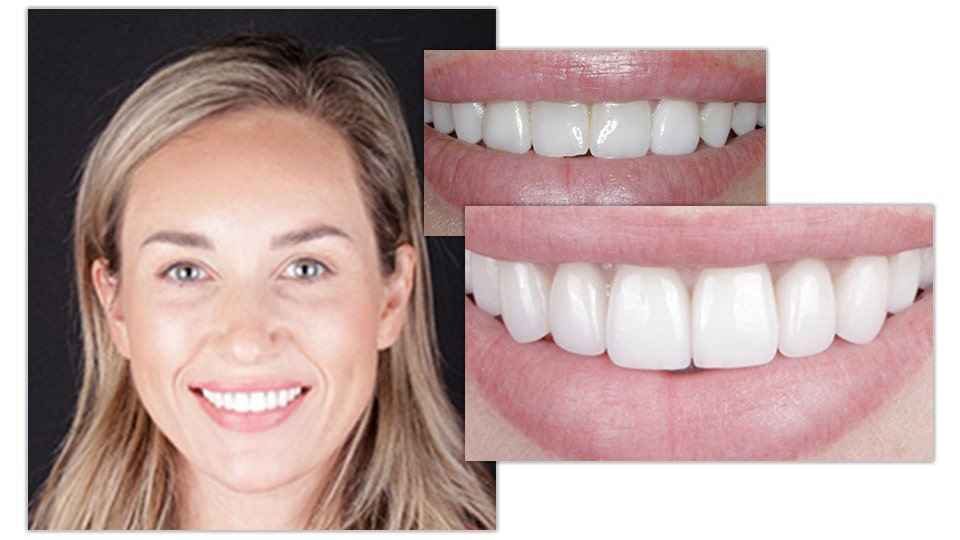 Pain-Free Cosmetic Dentistry 