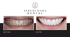 Minneapolis Cosmetic Dentists Specialists